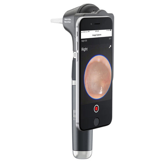 Welch Allyn MacroView Plus Otoscope