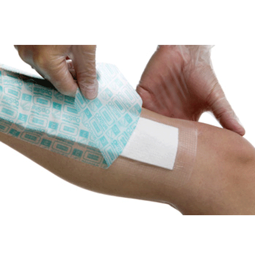 Opsite Post Op Composite Dressings
