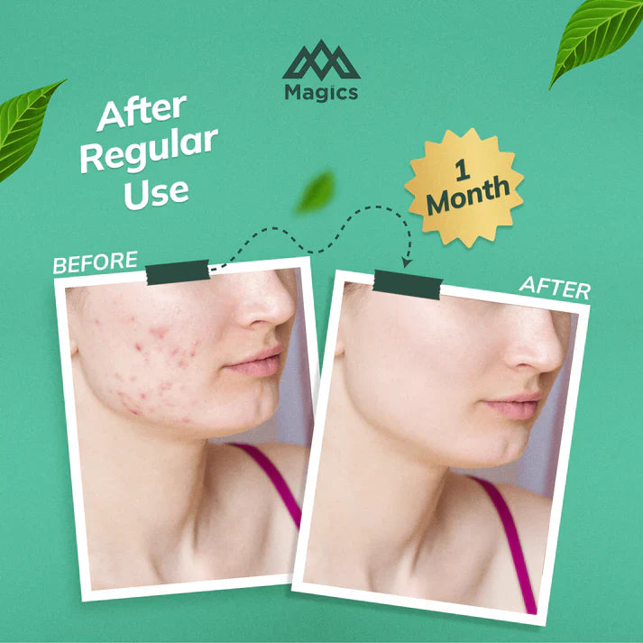 Magics Care Face Soap | ( Pack Of 2 )