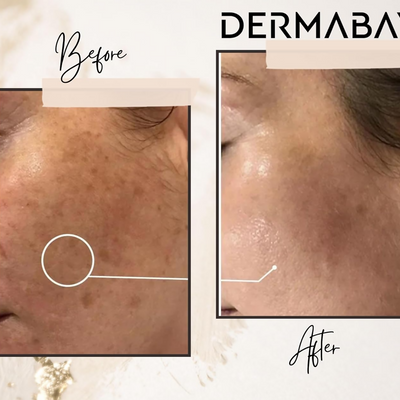 Dermabay Skin Brightening Face Serum With Kojic Acid & Alpha Arbutin