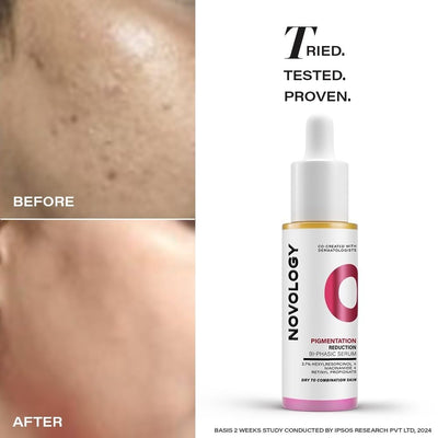 Novology Pigmentation Reduction Serum | Bi-Phasic Face Serum for Dark Spots and Hyperpigmentation | With Niacinamide + Pro-Retinol + Hexylresorcinol