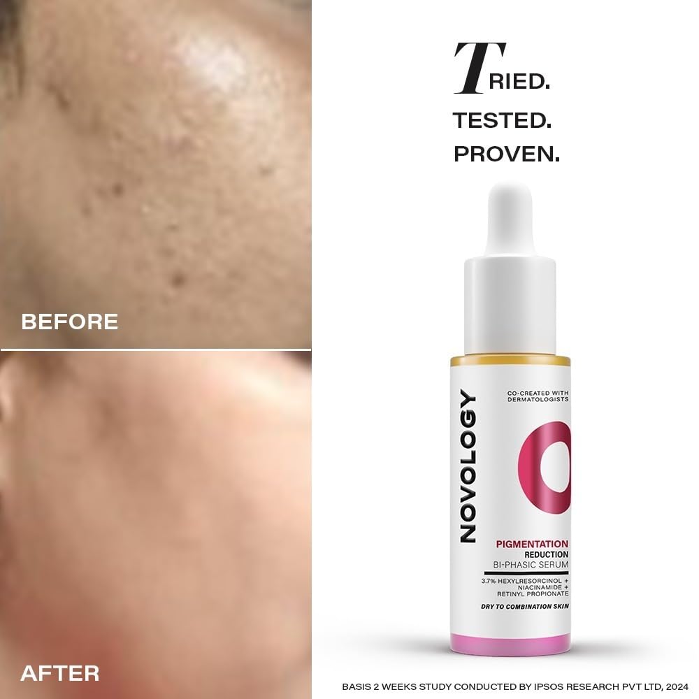 Novology Pigmentation Reduction Serum | Bi-Phasic Face Serum for Dark Spots and Hyperpigmentation | With Niacinamide + Pro-Retinol + Hexylresorcinol