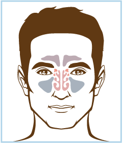 Alkalol Nasal Wash with Nasal Wash Cup Included