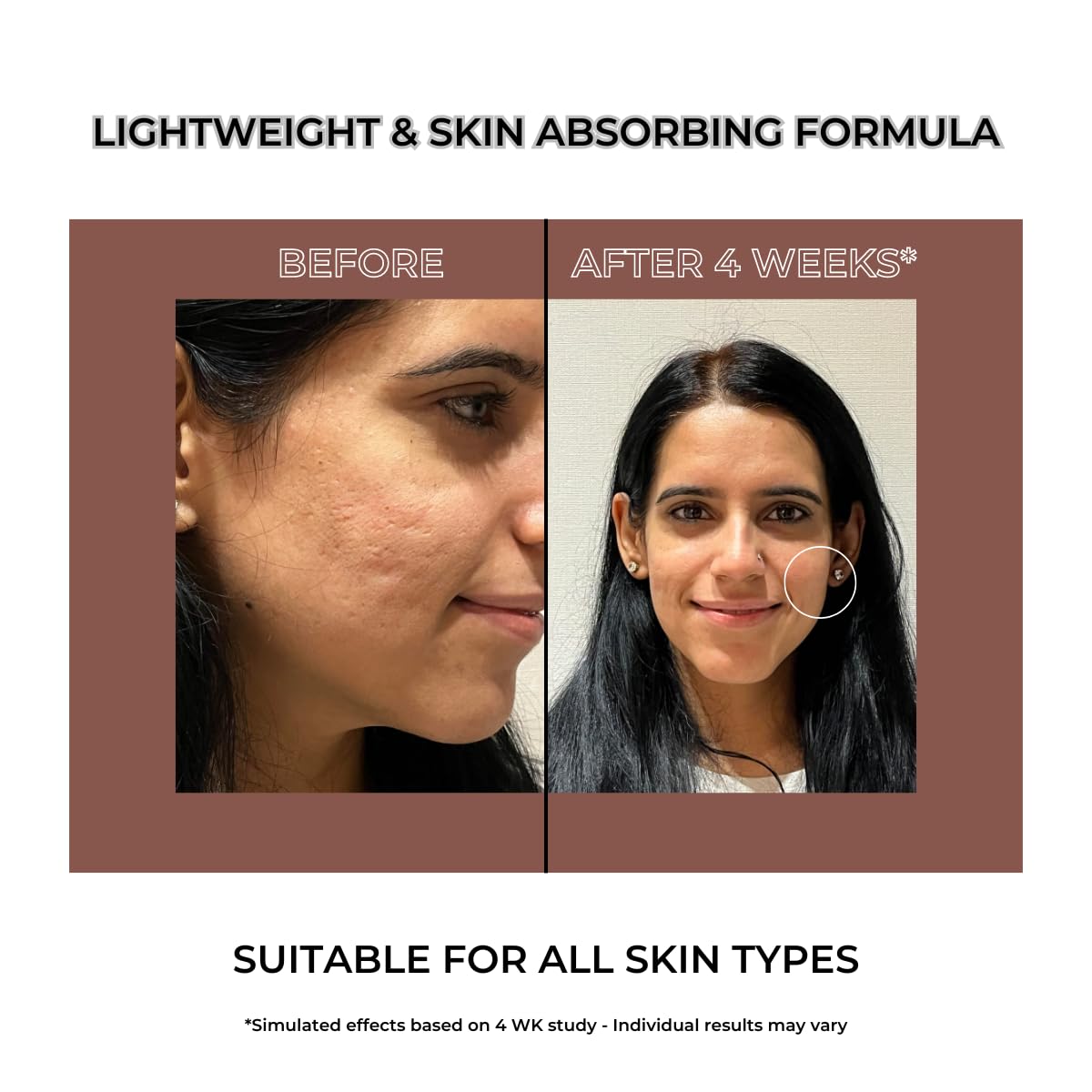 Alpha Mortal Advanced Face Serum with Niacinamide | Licorice extract, Glutathione, Kojic acid | Crafted for Hyperpigmentation & Melasma | Brightens skin tone & reduces dark spots | 30 ml