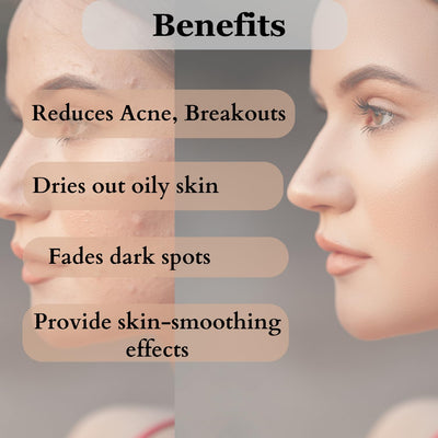 Dermistry 2% Salicylic Acid Niacinamide Anti Acne Deep Cleanser Oil Free Foaming Face Wash, Apple Cider, Zinc, Pimples & Excess Oil Removal for Oily Acne Pimple Prone Skin - Men Women