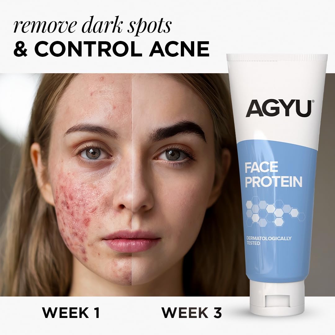 AGYU Face Protein Night Cream for Normal to Oily Skin | Repairs Pigmentation, Uneven Skin Tone & Dark Spots | Improves Skin Firmness | Beginner Friendly | 100Gm