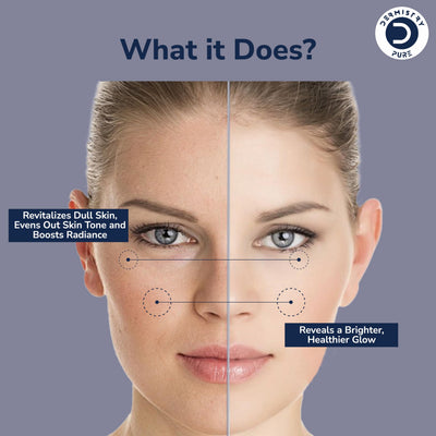 Dermistry Pure 10% Vitamin C 1% Alpha Arbutin Skin Lightening Brightening Glowing Fairness Face Serum Removes Dull Skin Pigmentation Dark Spots Corrects Radiance Repair Sun Damage 30ml