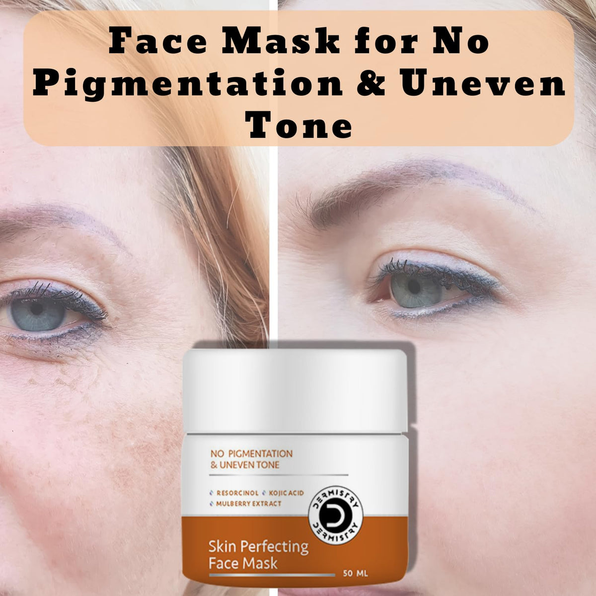 Dermistry 1% Kojic Acid Pigmentation Instant D De Tan Dark Spots Removal Skin Glow Lightening Brightening Face Pack Mask For Men Women - 50ml