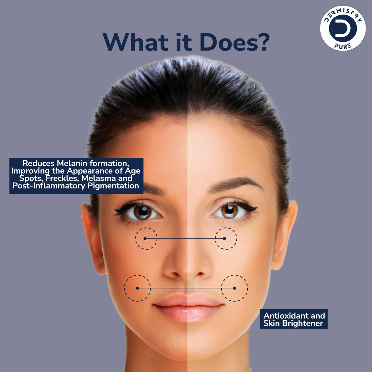 Dermistry Pure 2% Kojic Acid 1% Alpha Arbutin Skin Glowing Lightening Fairness Face Serum Removes Uneven Tone Dark Spots Pigmentation Tan & Dull Skin Suits All Skin Types 30ml