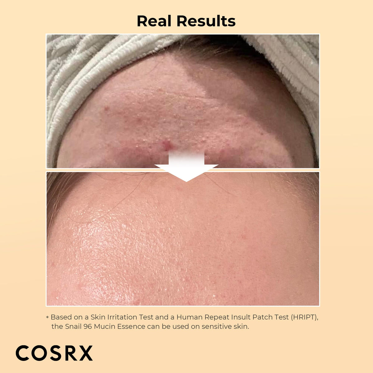 Cosrx Advanced Snail 96 Mucin Power Essence (100ml)