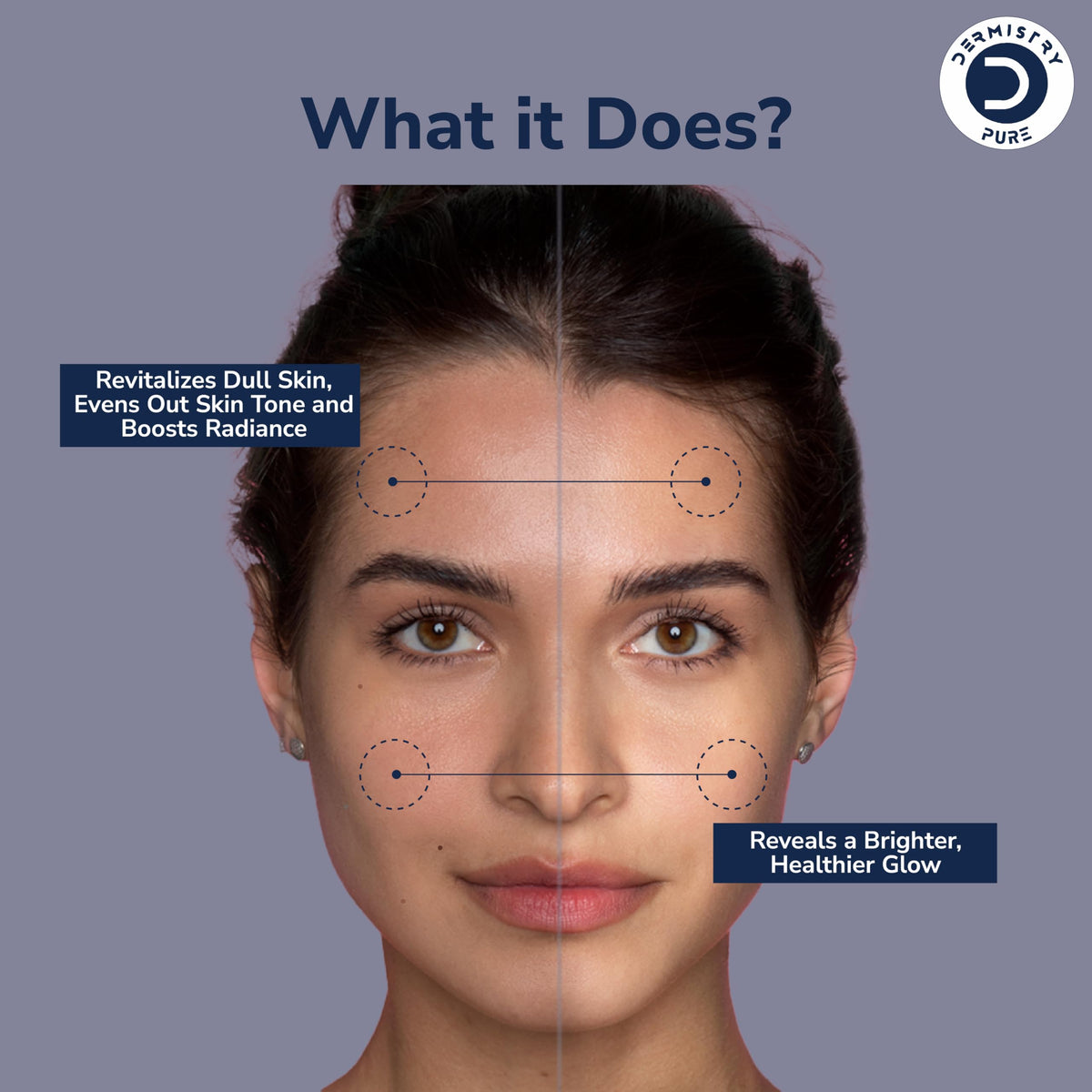 Dermistry 16% Vitamin C 1% Alpha Arbutin Skin Lightening Brightening Instant Glowing Fairness Face Serum Removes Pigmentation Dull Skin Dark Spots Corrects Radiance Sun Damage Repair 30 ml