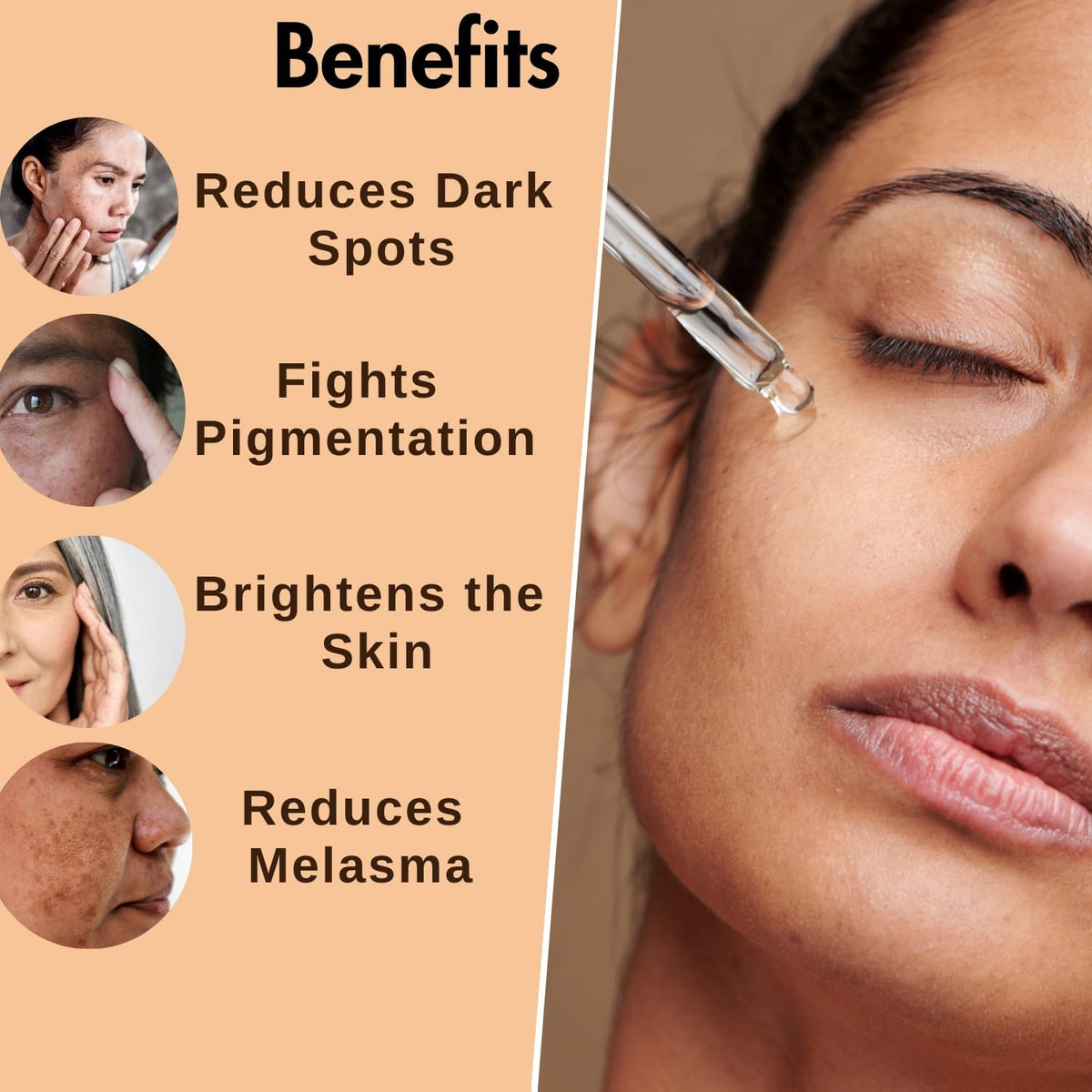 Dermistry 2% Kojic Acid Pigmentation Dark Spots Tan Removal Face Serum, Skin Lightening Brightening Glowing Fairness Glow Men Women, Removes Melasma Blemishes Acne Marks Uneven Tone Tanning