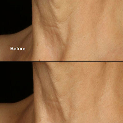 Clinique Smart Clinical Repair Lifting Face & Neck Cream
