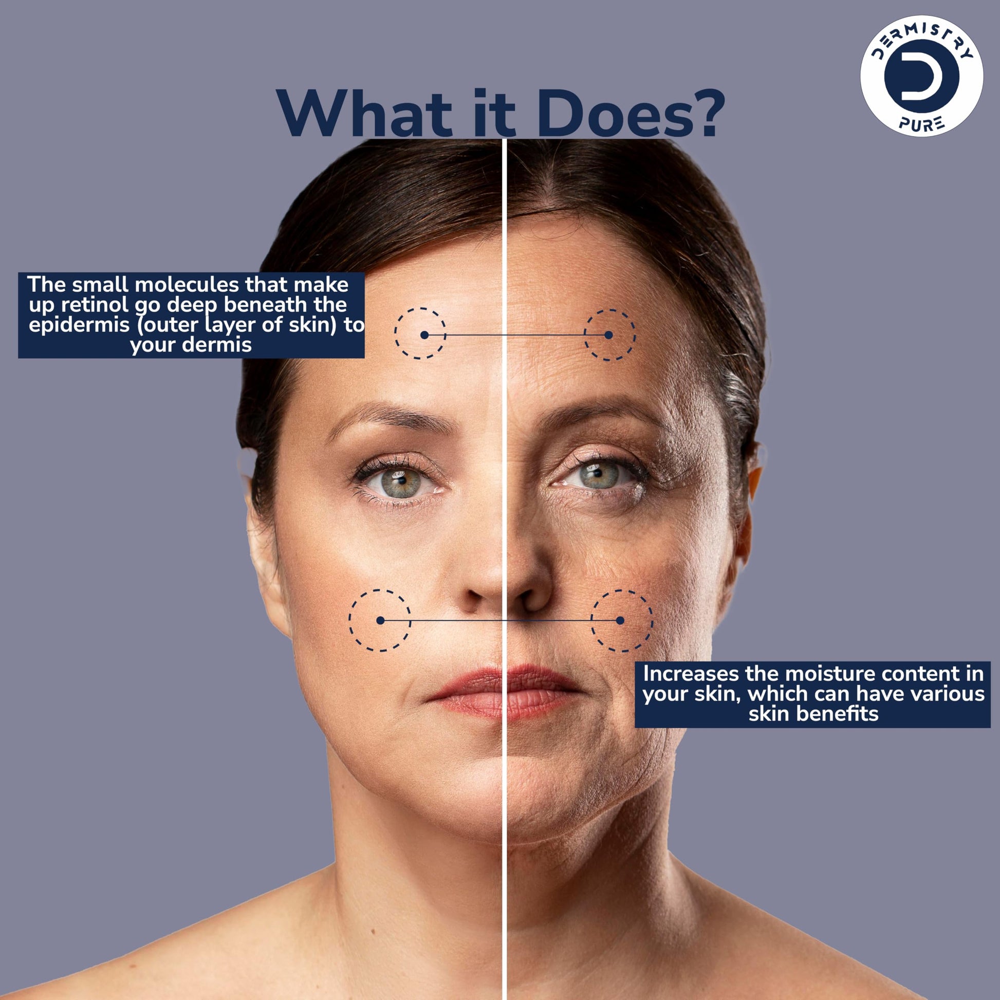 Dermistry Pure 1% Retinol 2% Hyaluronic Acid Anti Aging Skin Firming Tightening Moisturizer Face Serum Removes Ageing Fine Lines Wrinkles Deep Hydration Collagen Boost Improves Elasticity 30ml