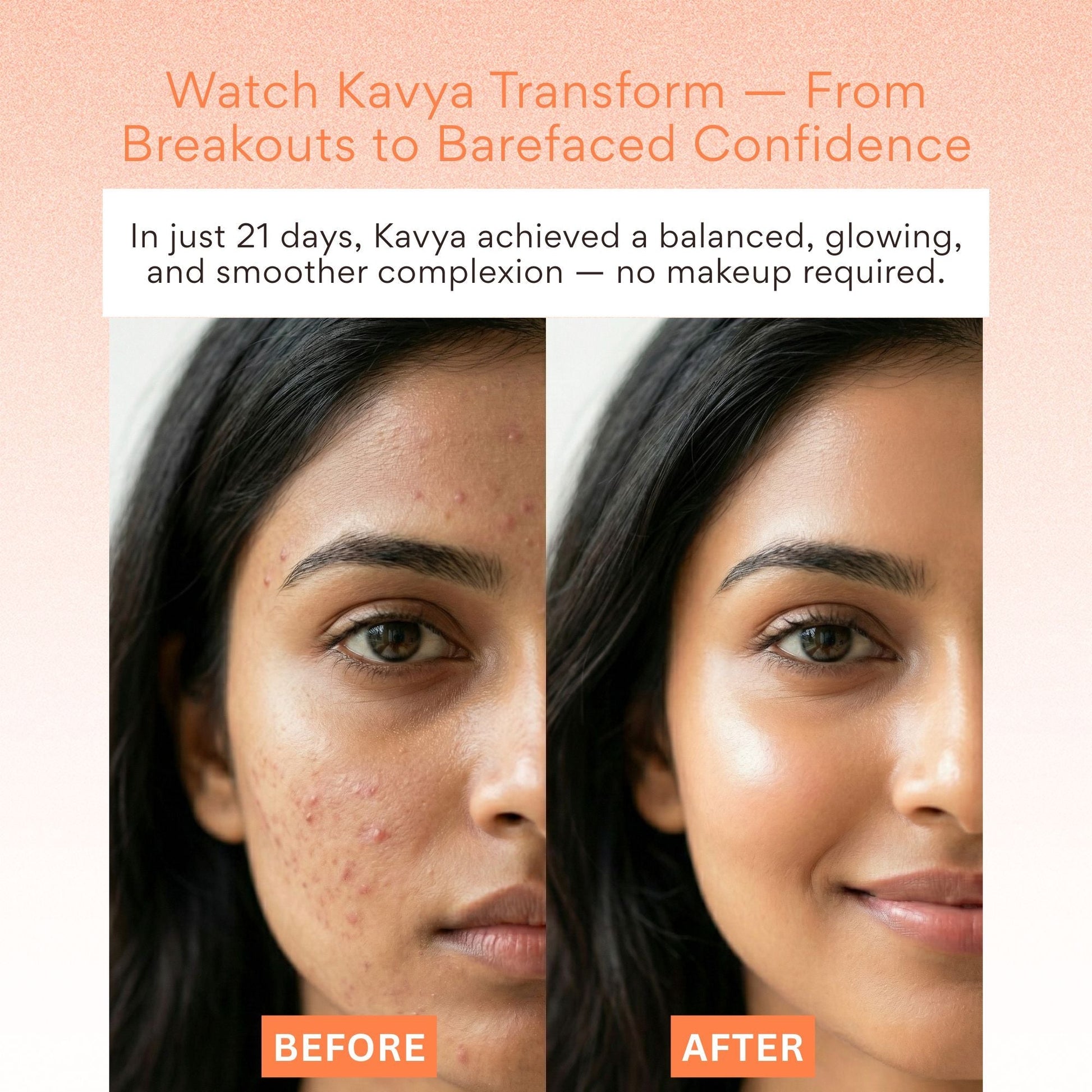 EOB 20% Vitamin C Serum with Hyaluronic Acid Face Serum