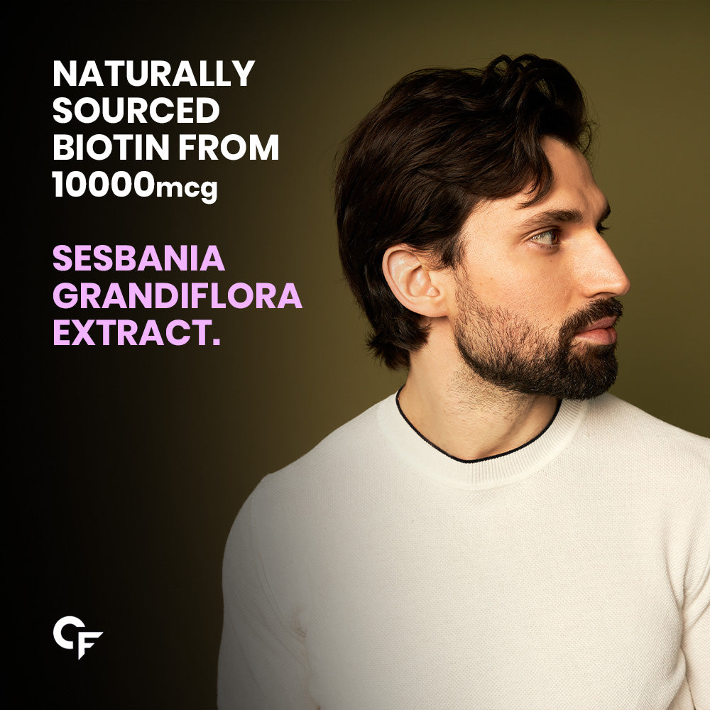 Carbamide Forte Biotin Tablets for Hair Growth with Amla, Brahmi & Bamboo Extract | Hair Growth Tablet | Hair Vitamins | Hair Supplements for Women & Men - 90 Veg Tablet