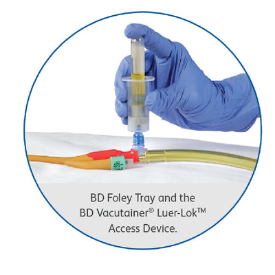 BD Vacutainer Luer-Lok Access Device with Pre-Attached Multiple Sample Adapter