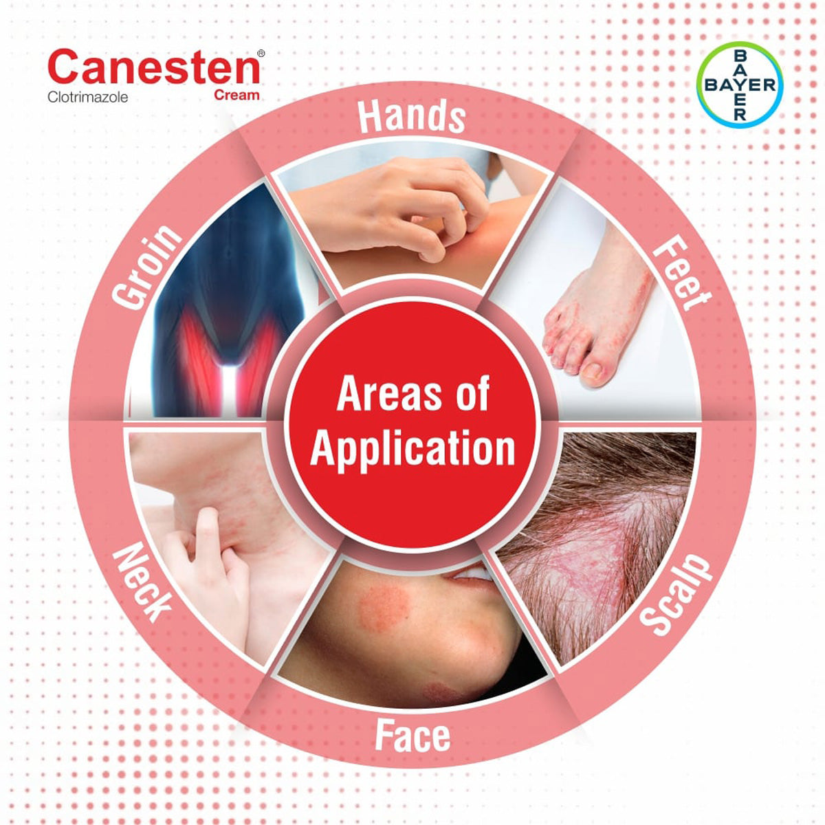 Canesten Cream - 30 gm