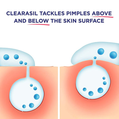Clearasil Ultra Rapid Action Cleansing Skin Pads, 90 Count