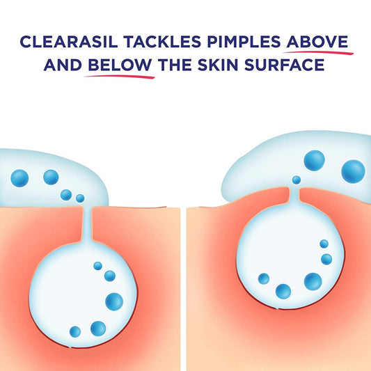 Clearasil Ultra Rapid Action Cleansing Skin Pads, 90 Count