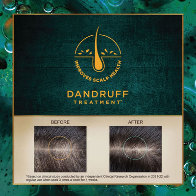 Indulekha Svetakutaja Oil for Dandruff Treatment