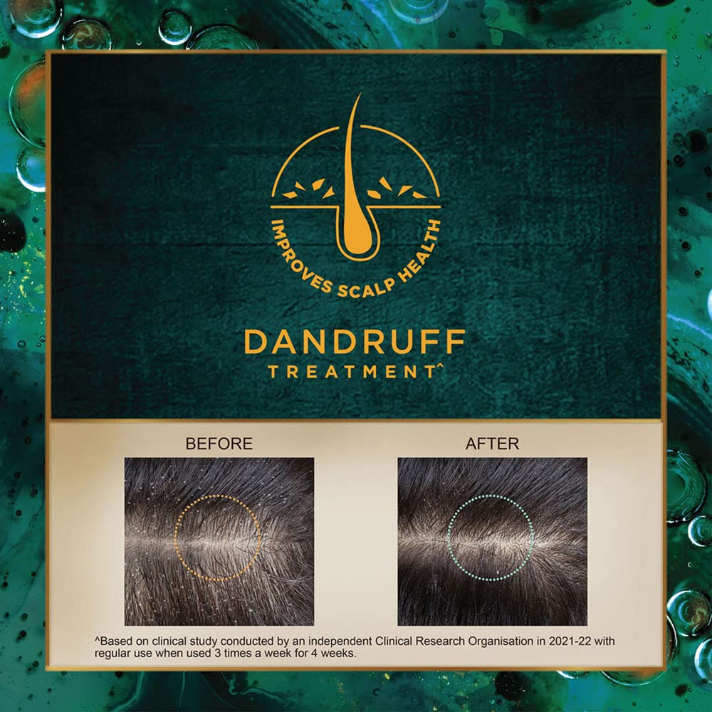Indulekha Svetakutaja Oil for Dandruff Treatment