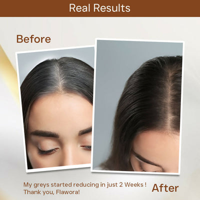 Flawora Anti-Grey Hair Serum With 1.5% Silverfree And 2% Melanogrey For Reversing Grey Hair