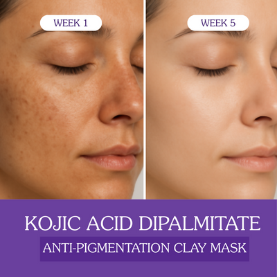 Bake Kojic Acid Anti-Pigmentation Clay Mask