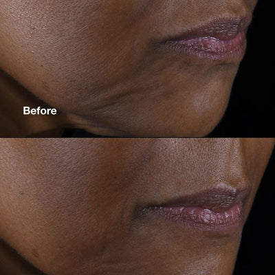 Clinique Smart Clinical Repair Lifting Face & Neck Cream