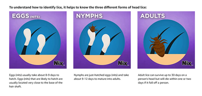 Nix Lice Killing Treatment Cream Rinse with Nit Comb -Kills Lice & Eggs (Nits)