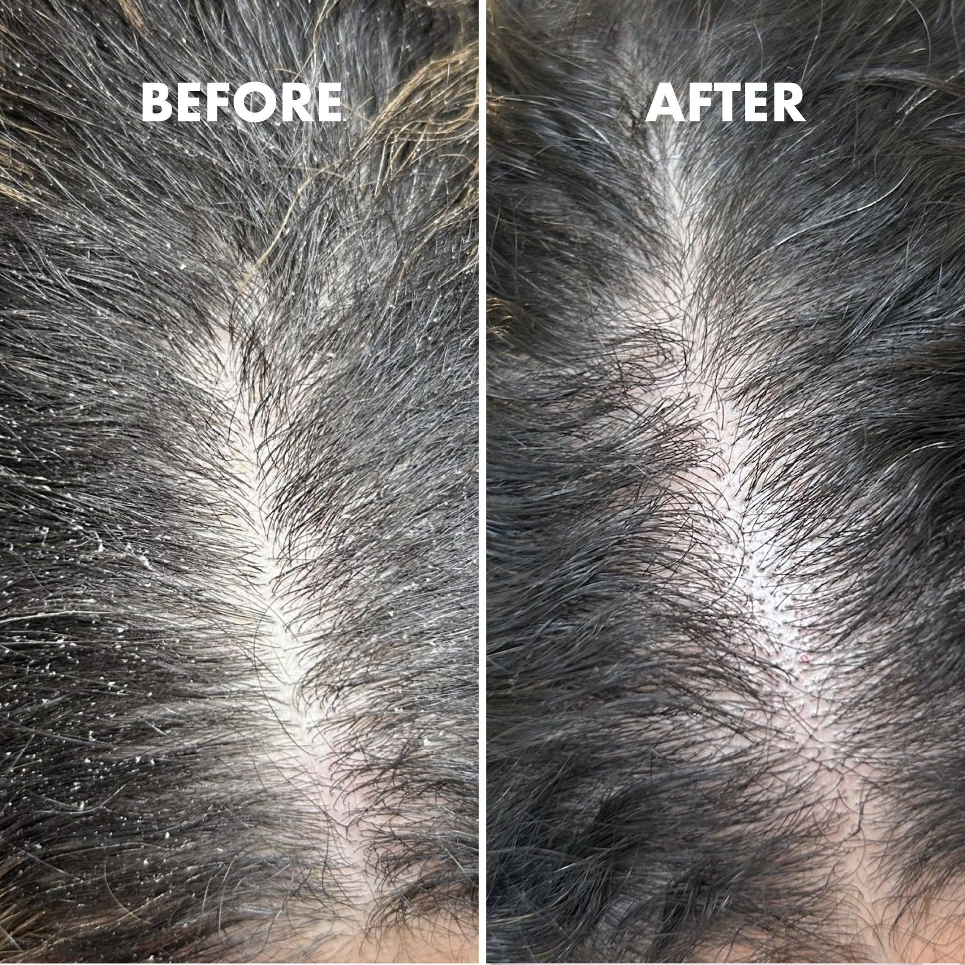 Scalp Restore Balancing Shampoo – 250ml