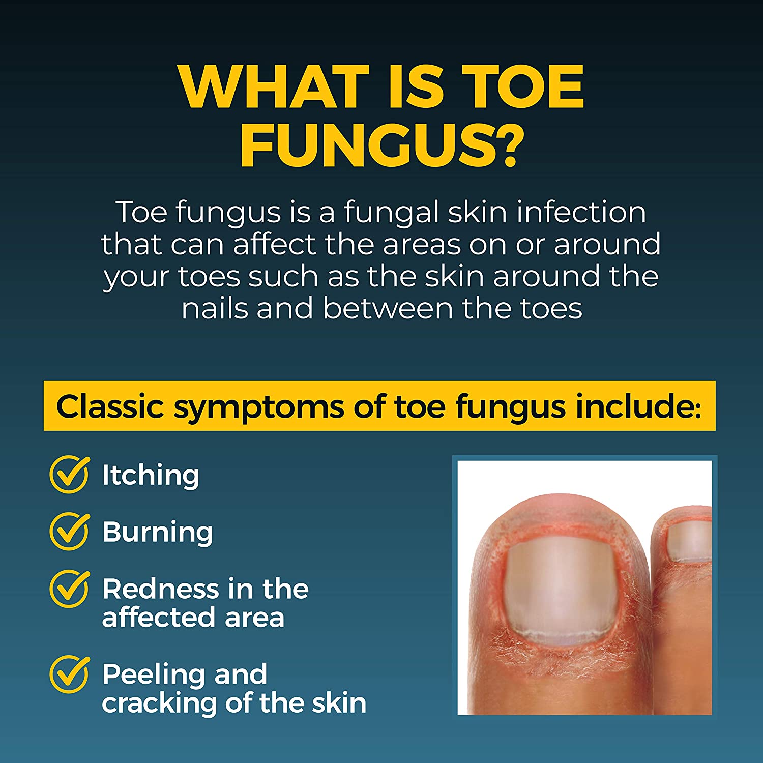 Fungi-Nail Antifungal Nail & Athlete’s Foot Ointment