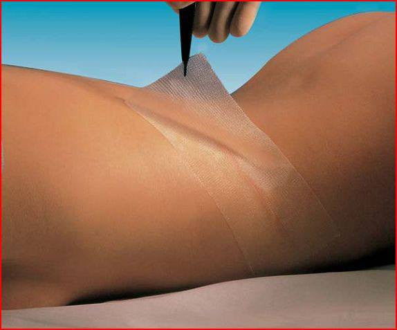 Oil Emulsion Impregnated Adaptic Non-Adhering Dressings 3 inch x 8 inch (Each)
