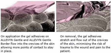 Allevyn™ Life Silicone Gel Adhesive Foam Border Dressings, 10/bx