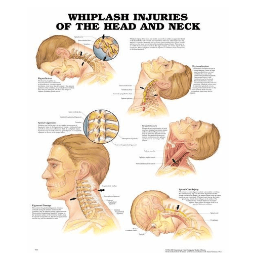 Anatomy Poster Wall Charts