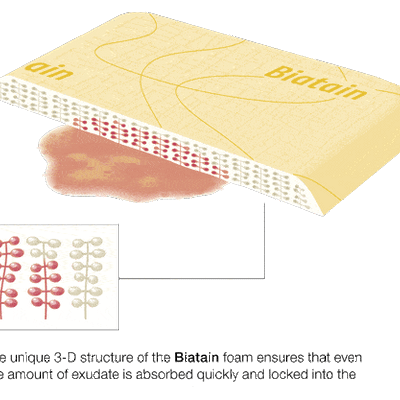 Biatain Sacral 9 x 9 Adhesive Border Dressings (5-Pack)