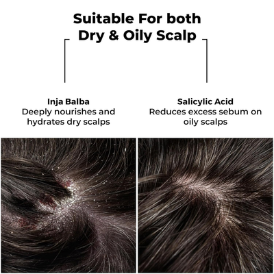 Brillare Dandruff Control Shampoo