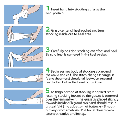 T.E.D. Thigh Length Anti-Embolism Stockings