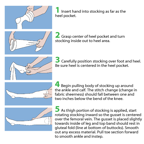 T.E.D. Thigh Length Anti-Embolism Stockings