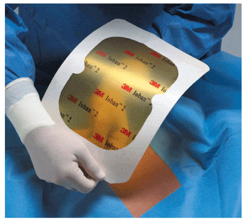 3M™ IOBAN™ 2 Antimicrobial Incise Drape 35” x 23” 10/box