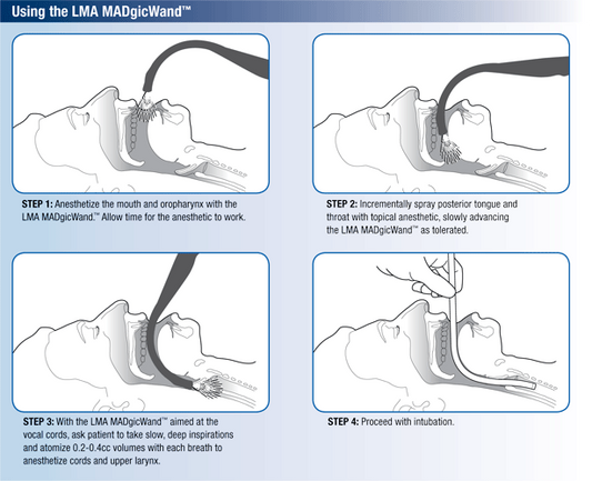 LMA MADgicWand Mucosal Atomizer Device with 5 mL Syringe 20/Case