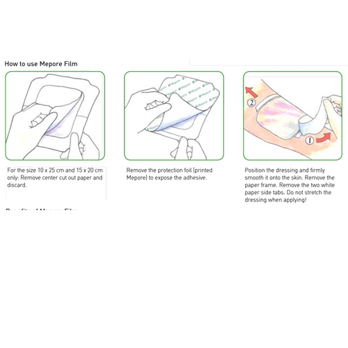 Mepore Clear Film Dressing