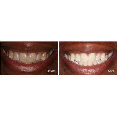 MI Paste with Recaldent 40 Gram Tube Tutti Frutti