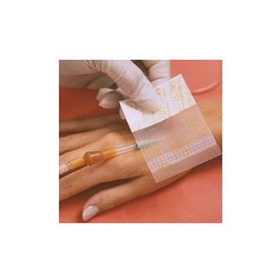 Opsite Flexigrid Transparent Dressing