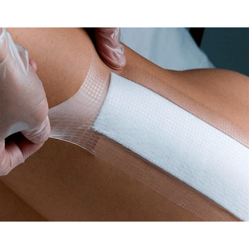 Opsite Post Op Composite Dressings