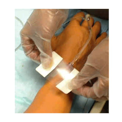 Opsite Flexigrid Transparent Dressing