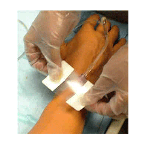 Opsite Flexigrid Transparent Dressing