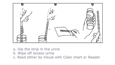 Uristix 4 Reagent Strips For Urinalysis 100/Bottle