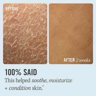 First Aid Beauty Ultra Repair Cream