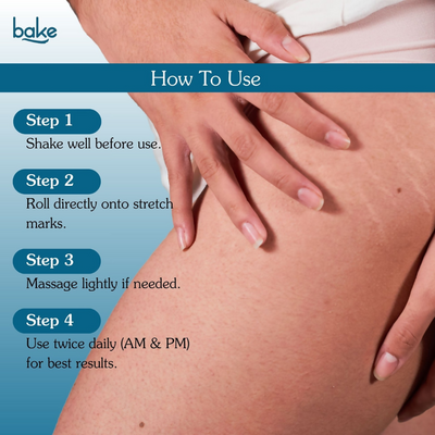 Bake StriErase™ Stretch Marks Removal Roll-On Serum